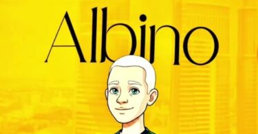 K Zungu Ft Tinko Mabao Albino